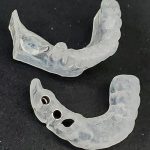 ガイデットサージェリー　シンプラントガイド　あいざわ歯科クリニック