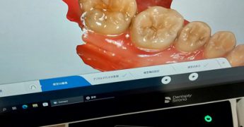 口腔内スキャナーIOS　あいざわ歯科クリニック